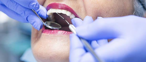 Best Emergency Dental Care for Sports Injuries in Ogden, NC